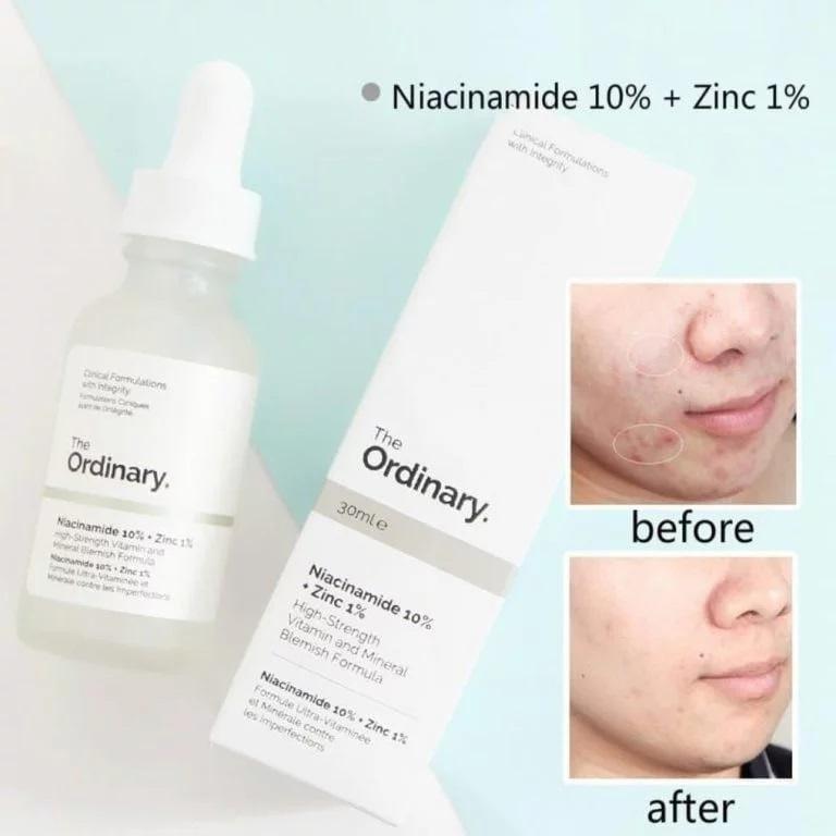 Niacinamide Serum - 30ml